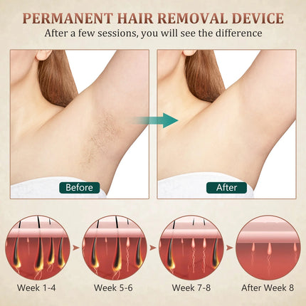 IPL Laser Hair Removal with Cooling System, Painless Permanent Hair Remover for Full Body Hair, Green